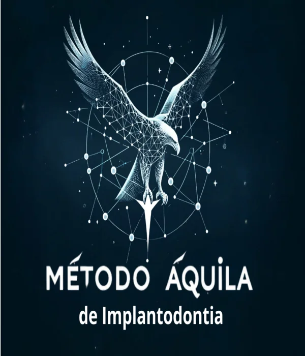 Método Áquila de Implantodontia Igor Rizo
